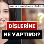 Diş Estetiğinin Akabinde Lisanlara Büyük Düşen Hazal Kaya’nın Yaptırdığı Süreçleri ve Değişimini İnceliyoruz!