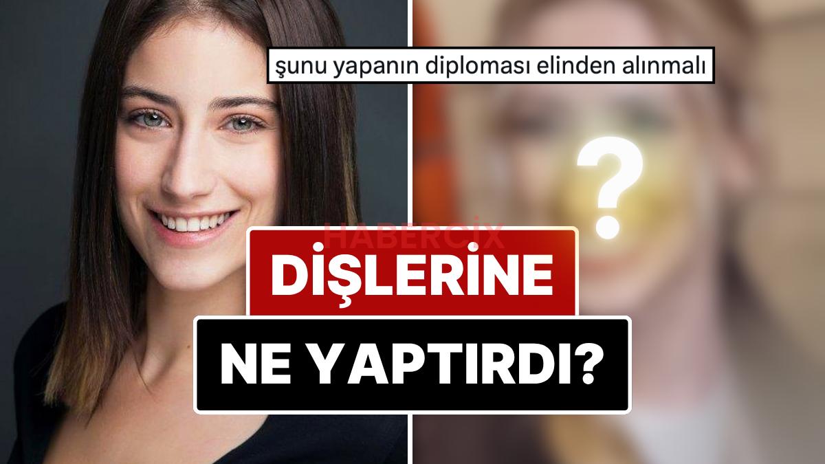 Diş Estetiğinin Akabinde Lisanlara Büyük Düşen Hazal Kaya’nın Yaptırdığı Süreçleri ve Değişimini İnceliyoruz!