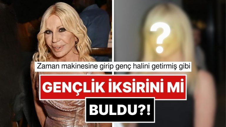 Dolgularını Eritmişti: 70 Yaşındaki Donatella Versace’nin Son Hali Aklımızı İzanımızı Şaşırttı!