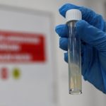 Dünyanın en ölümcül bulaşıcı hastalığı geçen yıl 1,23 milyon can aldı