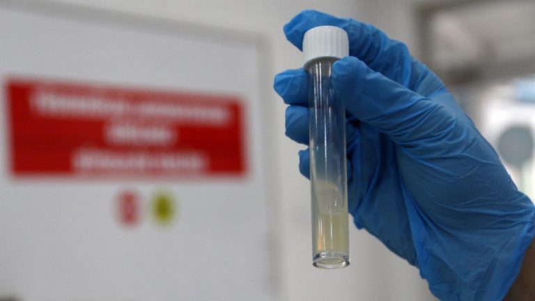 Dünyanın en ölümcül bulaşıcı hastalığı geçen yıl 1,23 milyon can aldı