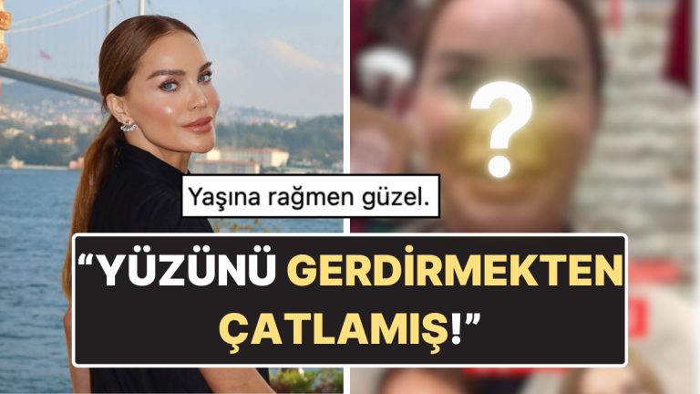 Ebru Şallı’nın Filtresiz ve Photoshopsuz Hali Ortaya Çıktı: Yüzünün Son Hali Tartışma Yarattı!