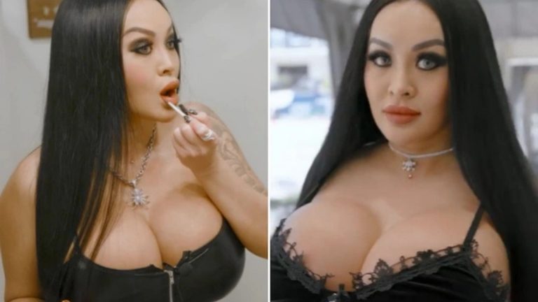 Estetik Yaptırdıktan Sonra Ailesinin Kendisinden Utandığını Söyleyen Kadından Dumur Eden Açıklamalar