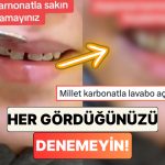 İnternette Her Gördüğünüzü Denemeyin! Bir Dişçi Dişini Karbonatla Fırçalayan Bir Hastanın Durumunu Paylaştı