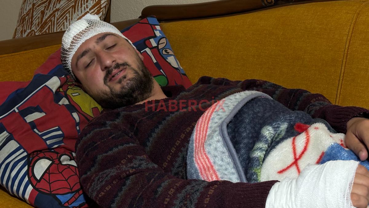 Kocaeli’de otizmli şahıs odunluğa baktı diye odunla darbedildi