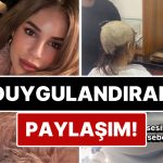 Meme Kanseriyle Mücadele Ettiğini Duyuran Oyuncu Irmak Ünal Saçlarını Kazıttığı Anları Paylaştı