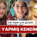 Yüzündeki Değişiklikle Son Hali Dikkat Çeken Hazal Kaya’nın Dişlerine Yaptırdığı Süreç Sınıfta Kaldı