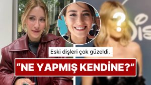 Yüzündeki Değişiklikle Son Hali Dikkat Çeken Hazal Kaya’nın Dişlerine Yaptırdığı Süreç Sınıfta Kaldı