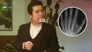 ABD’de moleküler biyolog, eline yerleştirdiği mikroçipin şifresini unuttu