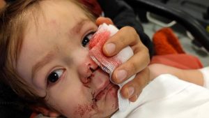 Ankara’da iki çocuğu yaralayan pitbull ve sahibi yakalandı