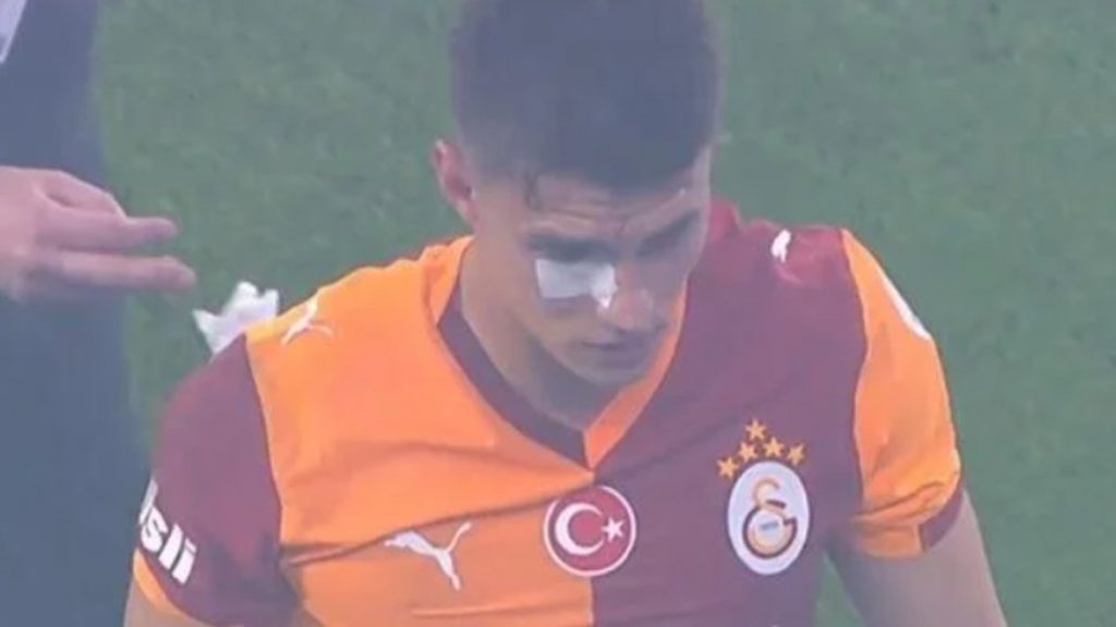 Kazımcan Karataş’a derbide yabancı madde geldi!