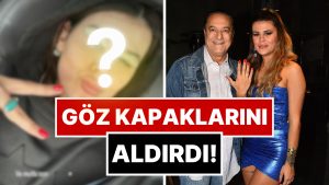 Muradına Erdi: Mehmet Ali Erbil’İn Kendisinden 40 Yaş Küçük Eşi Gülseren Ceylan Estetik Yaptırdı!